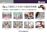 GOKO映像機器株式会社の毛細血管スコープ(血流スコープ)のカタログ